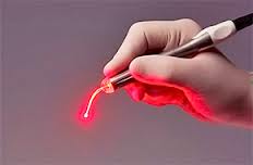 Photo: implantation laser