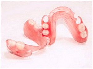 Photo: Prothèses en nylon en présence de défauts terminaux des dents