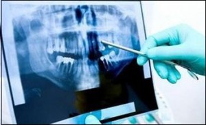 Photo: examen radiographique du patient avant la chirurgie