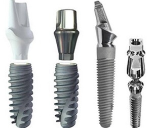 photo: Types d'implants dentaires
