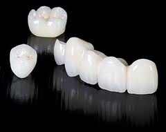 Photo: couronnes dentaires