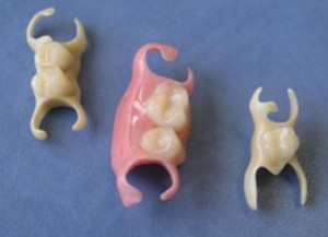 Photo: prothèses dentaires amovibles papillon