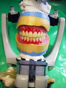 الصورة: وضع الأسنان في المفصل