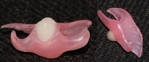 Photo: Prothèse en nylon pour une dent