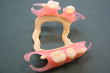 Photo: Prothèse en nylon pour la restauration des dents manquantes