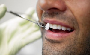 Photo: Restauration des dents de placage
