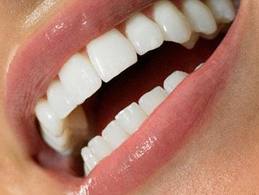 Photo: Dents après restauration directe