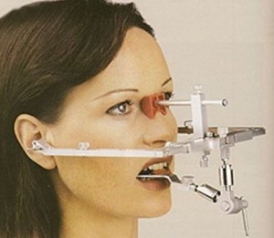 Photo: Arc facial orthopédique