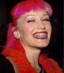 Photo: Gwen Stefani en appareil dentaire