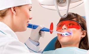 Photo: Blanchiment des dents au laser