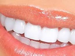 Photo: Dents après blanchiment professionnel