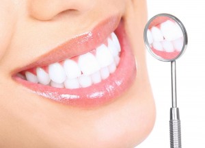 Photo: Dents après blanchiment professionnel