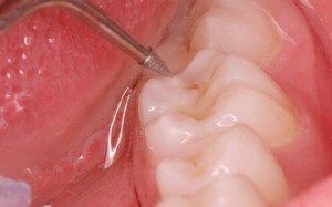 Photo: Brosse à dents à ultrasons