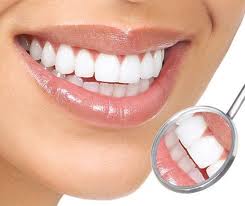 Photo: Dents après blanchiment