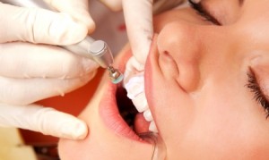 Photo: Blanchiment des dents chez le dentiste
